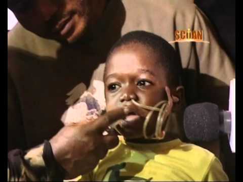 Т. Б. Джошуа ( TB Joshua) Помазание воды Boy healed after acid
