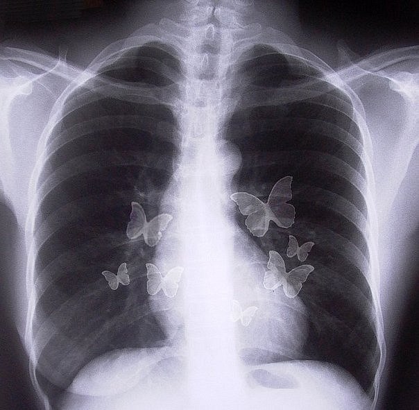 Екатерина Сотникова | Орёл