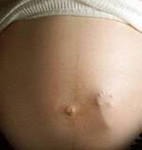 Юлия Юрченко | Черепаново