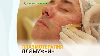 Плазмотерапия для мужчин