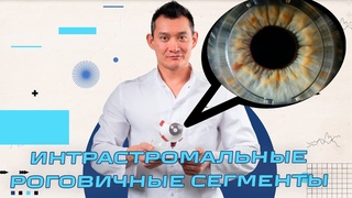 Интрастромальные роговичные сегменты или кольца (ИРС) - Спасение от кератоконуса
